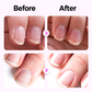 🔥✨Kaufe 1 und erhalte 1 gratis 💜2025 Neuer und verbesserter 3-in-1-Nagelpflegestift.